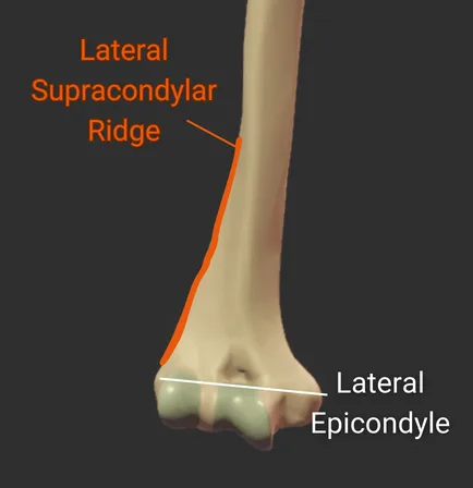 Supracondylar Ridges - anterior - isolated